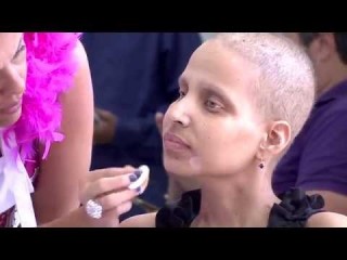 Ex-modelo cria projeto com dicas de beleza para mulheres com câncer